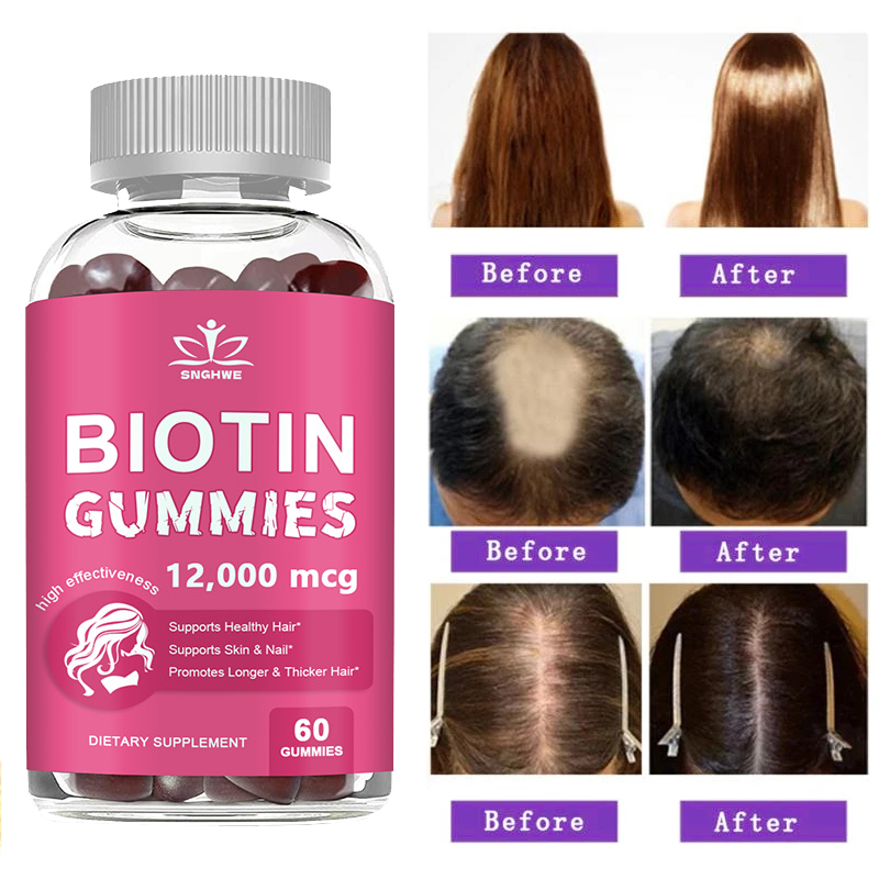 Hair Care Gummies - Collagen Gummies Biotin Gummies for Skin