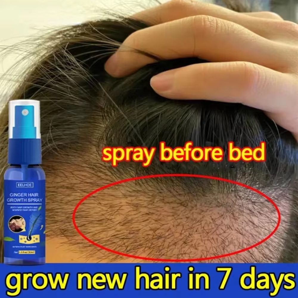 Hair Care For Men - Fast Ginger Hair Growth Spray Roots