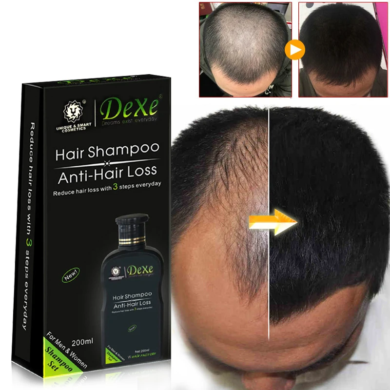 Professional hair growth Shamp - Hair Care Herbal recension och pris