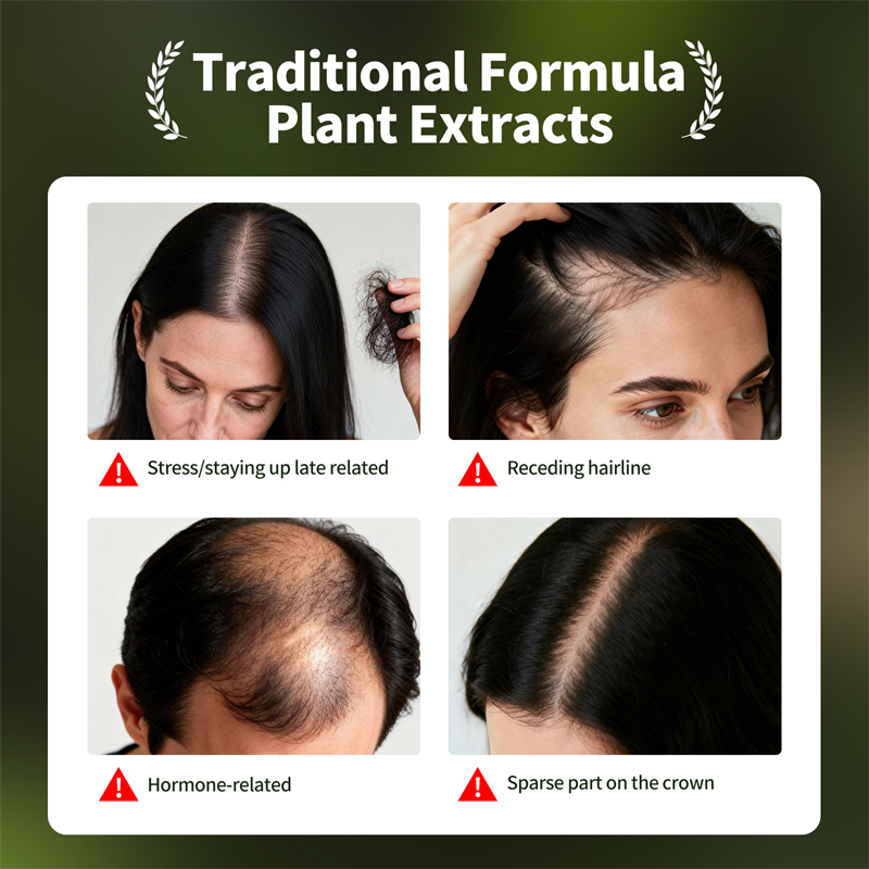 Natural Hair Growth Set Usman  - Hair Care Herbal recension och pris