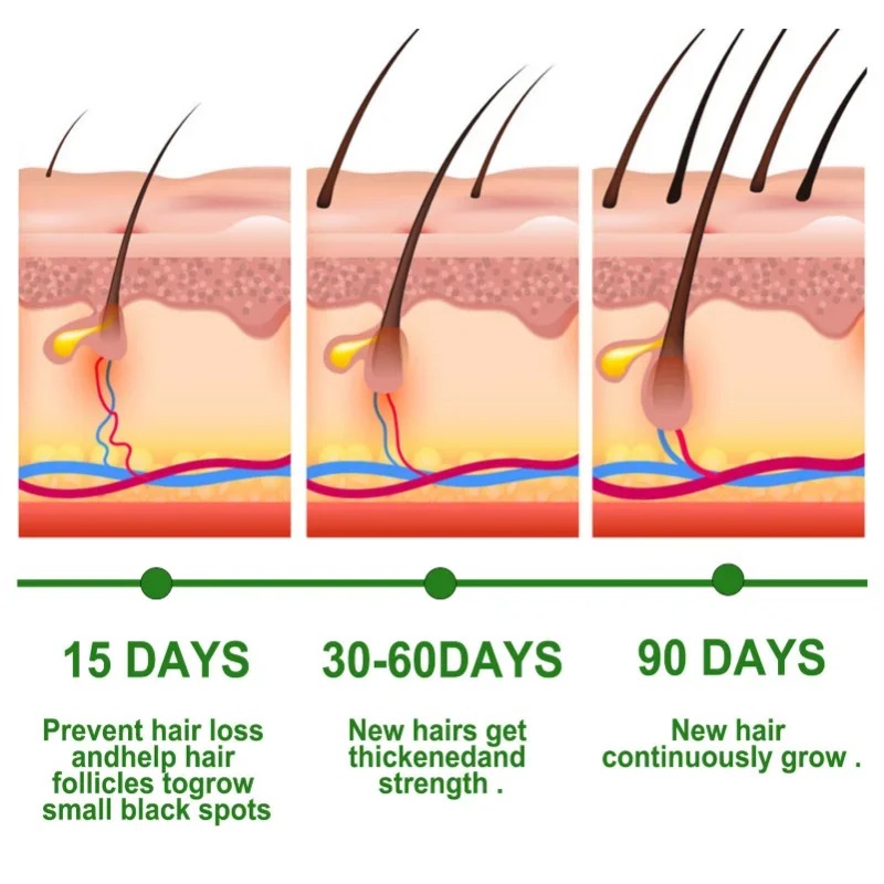 Hair Growth Serum Fast Growing - Hair Care Essential Oil Atomizing recension och pris