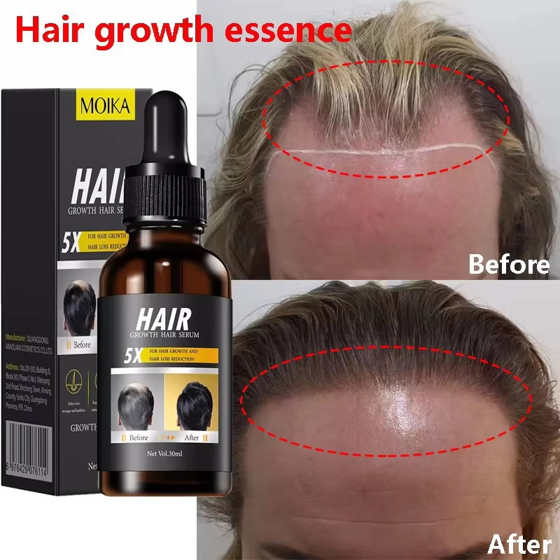 Fast Hair Growth Serum Hair Re - Hair Care Essential Oil Atomizing recension och pris