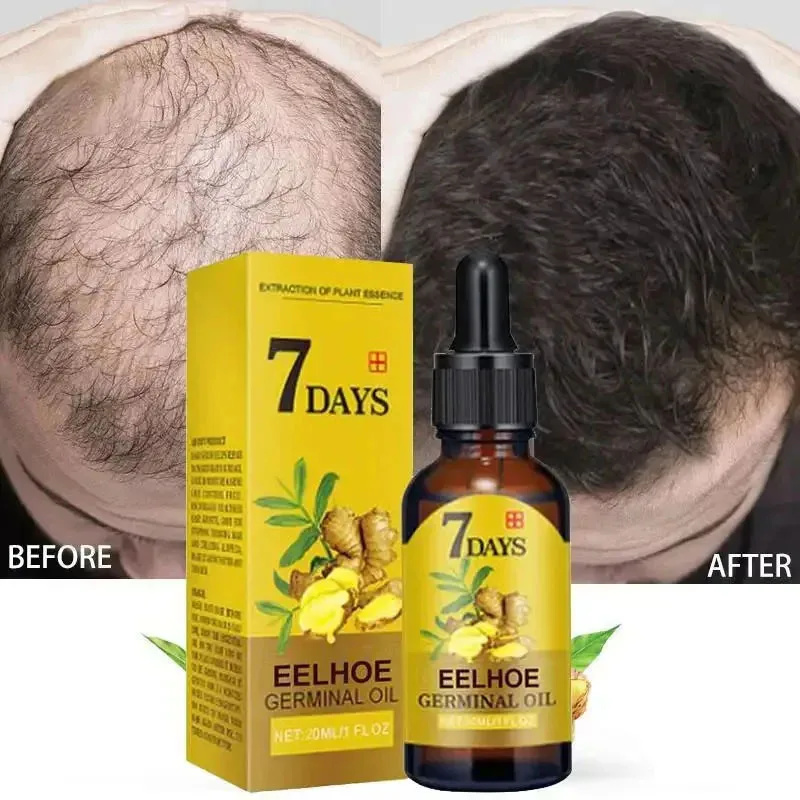 7 Day Fast Hair Growth Serum G - Hair Care Essential Oil Atomizing recension och pris