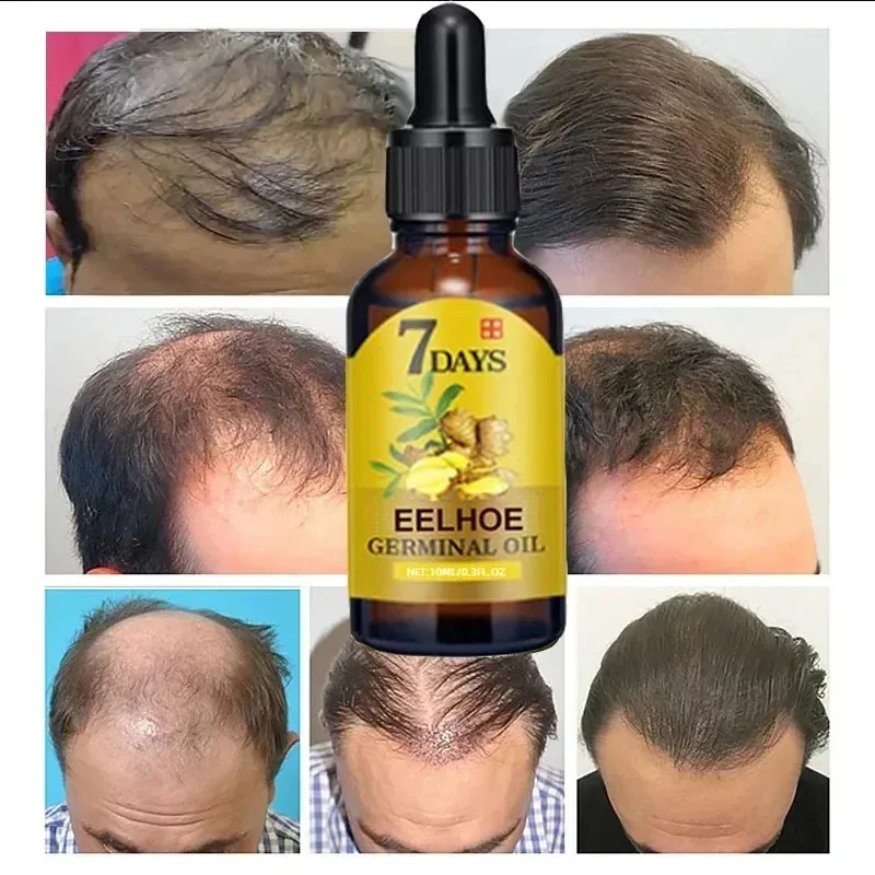 7 Day Fast Hair Growth Serum G - Hair Care Essential Oil Atomizing recension och pris