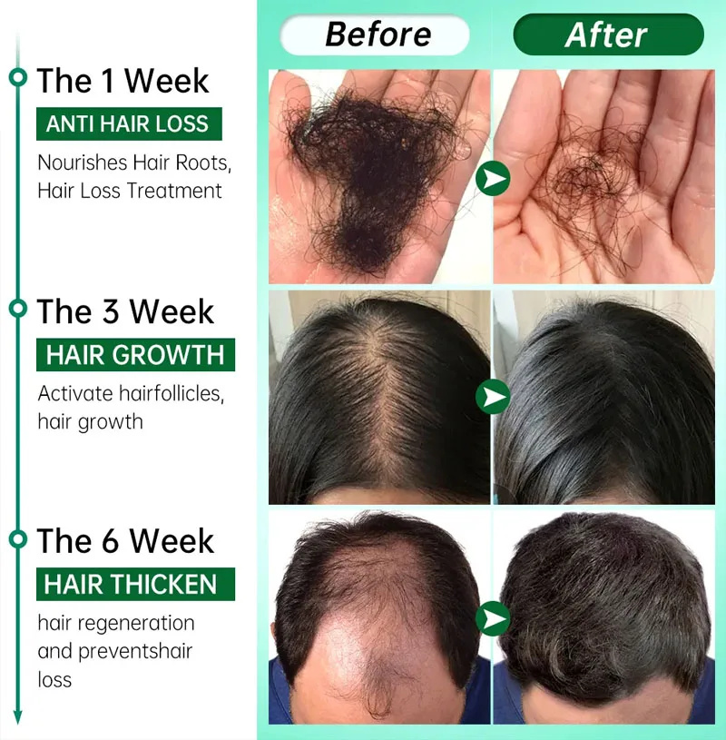 7 Day Fast Hair Growth Serum G - Hair Care Essential Oil Atomizing recension och pris