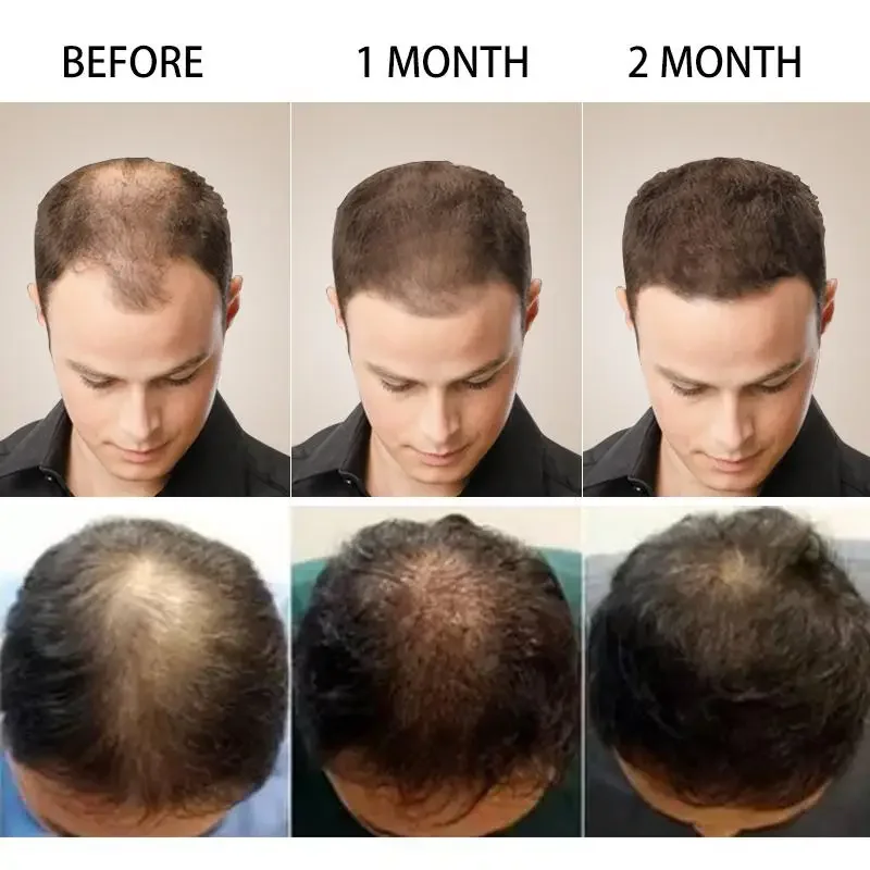 Hair Growth Ginger Fast Growin - Hair Care Essential Oil Atomizing recension och pris
