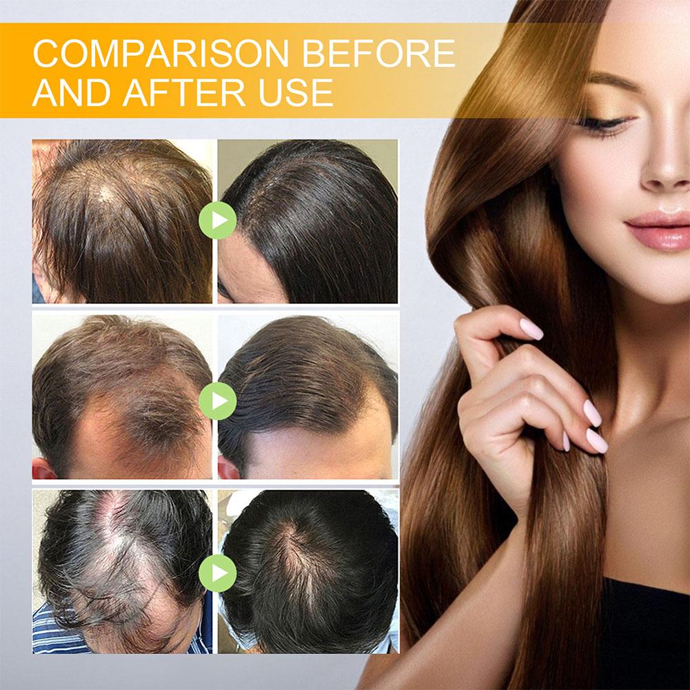 5/3/1pcs Biotin Fast Hair Grow - Hair Care Herbal recension och pris